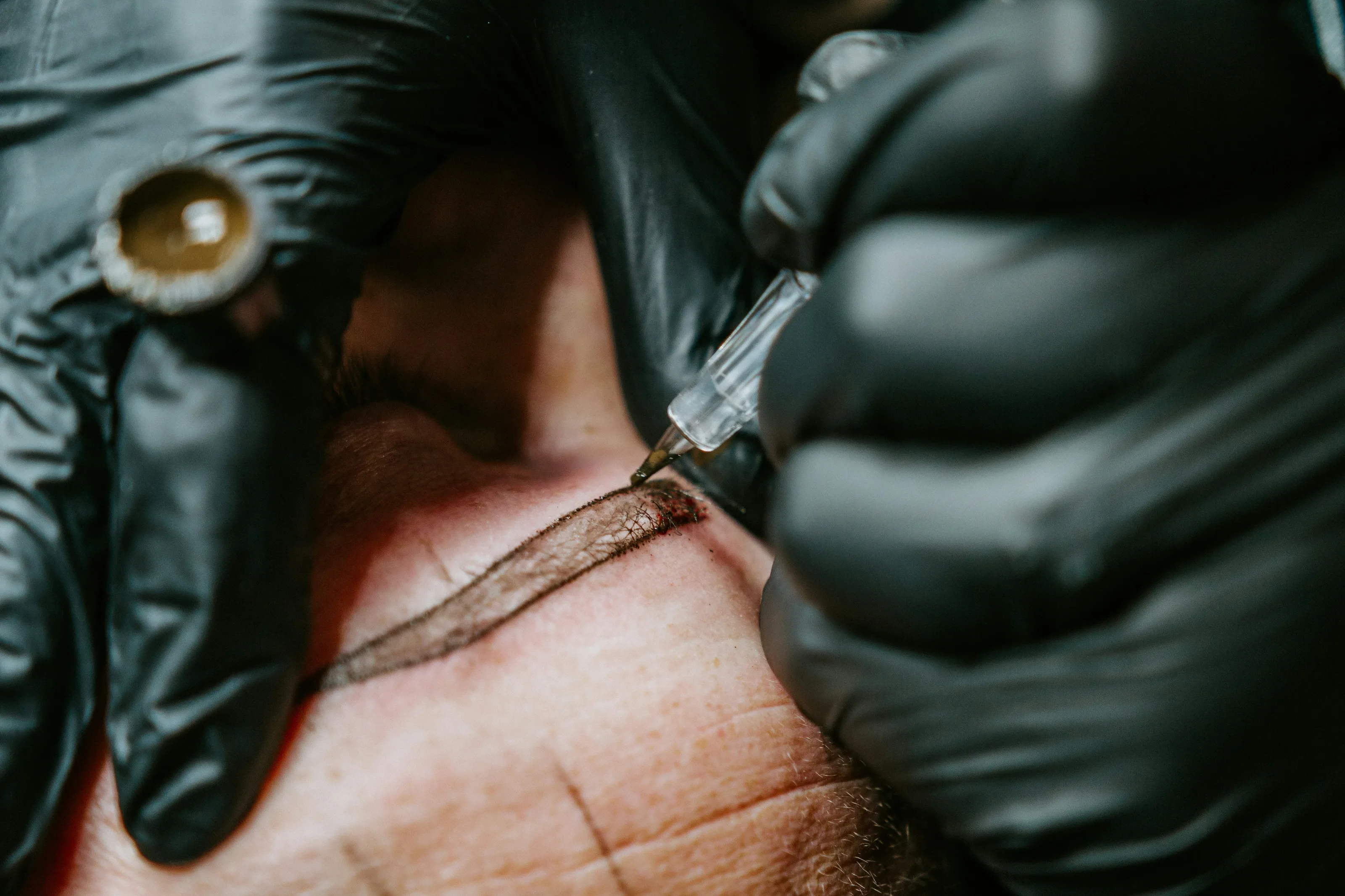 Close-up of a gloved hand holding a micropigmentation machine needle against the skin